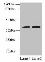 KLHDC8A Antibody (PACO37846)