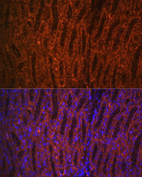 Anti-PCK1 Antibody (CAB2036)