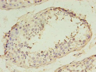 SPANXD Antibody (PACO37998)
