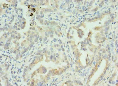S100PBP Antibody (PACO38114)
