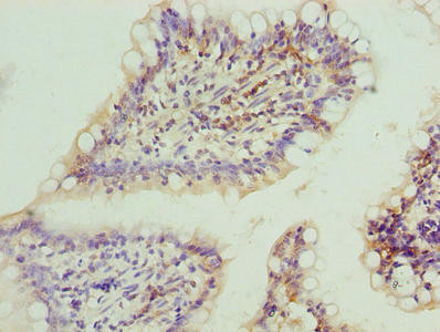 FAR2 Antibody (PACO38174)