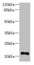TTC9C Antibody (PACO38546)