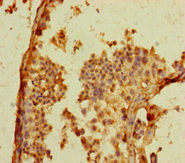 GPR156 Antibody (PACO39158)