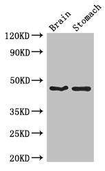 TBC1D20 Antibody (PACO39270)