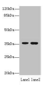 EEF2KMT Antibody (PACO39830)