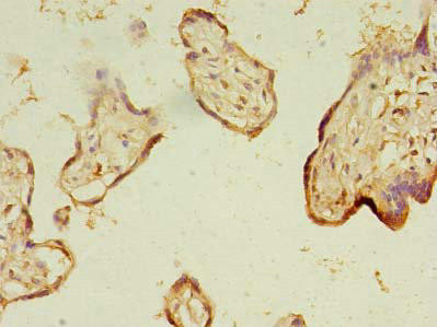 NARS2 Antibody (PACO40138)