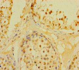 DUSP21 Antibody (PACO41334)