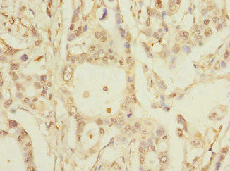PKD2L2 Antibody (PACO41754)