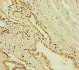 ZNF71 Antibody (PACO41962)