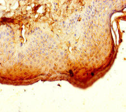 ALG12 Antibody (PACO42102)
