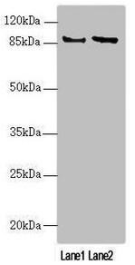 MAPK8IP2 Antibody (PACO45641)