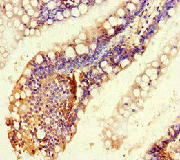 RTEL1 Antibody (PACO46182)