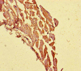 TECPR1 Antibody (PACO46730)
