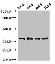 lplA Antibody (PACO50418)