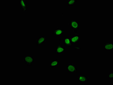 TRAPPC11 Antibody (PACO50746)