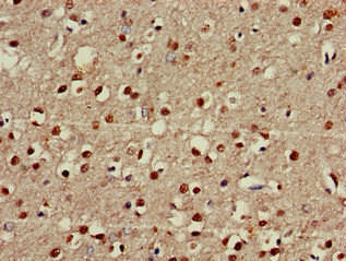 FOXRED2 Antibody (PACO52534)