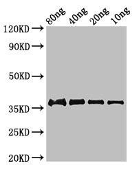 fbpC Antibody (PACO53434)