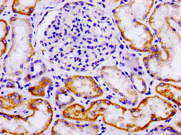 LAMA3 Antibody (PACO55942)