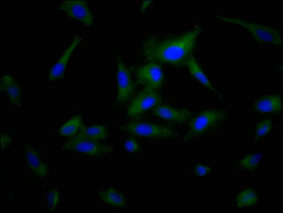 POPDC3 Antibody (PACO57520)