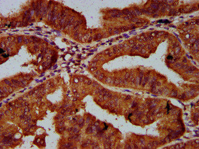 CUL7 Antibody (PACO59045)