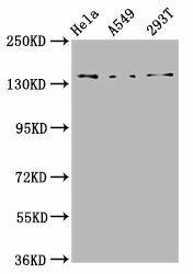 CNGB1 Antibody (PACO59085)