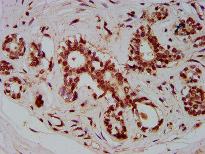 ZMIZ1 Antibody (PACO59533)