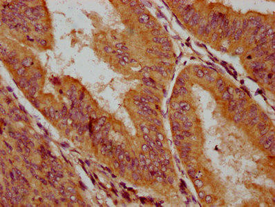 HLCS Antibody (PACO59740)