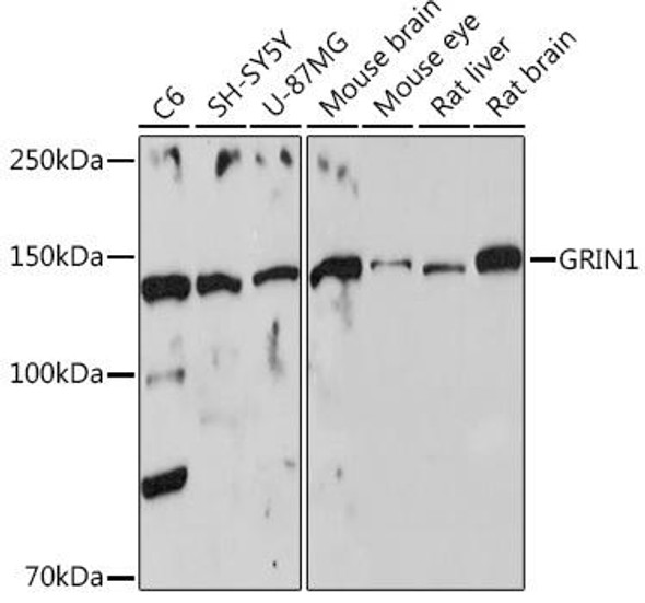 Anti-GRIN1 Antibody (CAB7677)