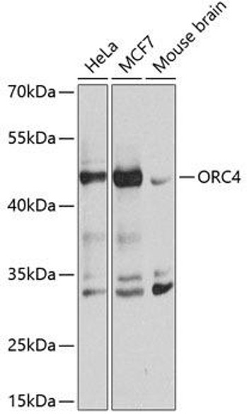 Anti-ORC4L Antibody (CAB7705)