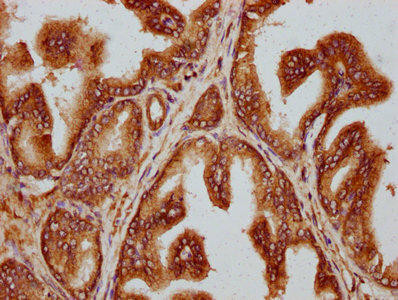 TTLL3 Antibody (PACO59960)