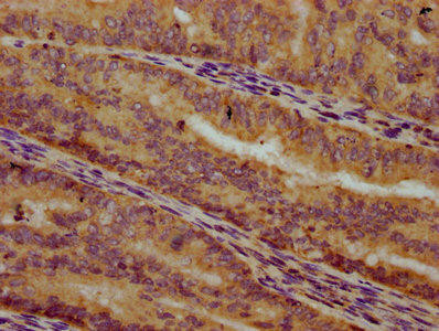 ALG10 Antibody (PACO60068)