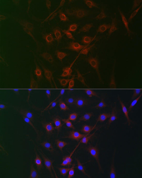 Anti-RRAGA Antibody (CAB7771)