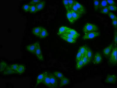 MOCS2 Antibody (PACO60945)