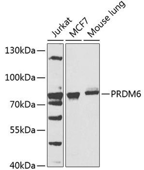 Anti-PRDM6 Antibody (CAB7846)