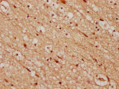 CELF4 Antibody (PACO61221)