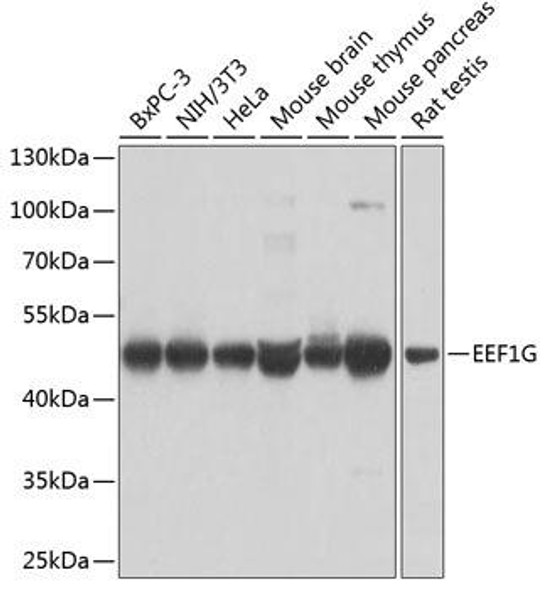 Anti-EEF1G Antibody (CAB7891)