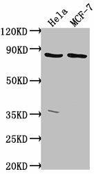 TTC39B Antibody (PACO61714)