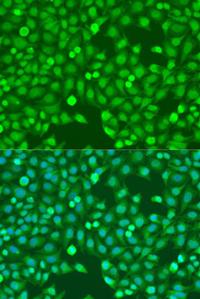 Anti-MEF2A Antibody (CAB7911)