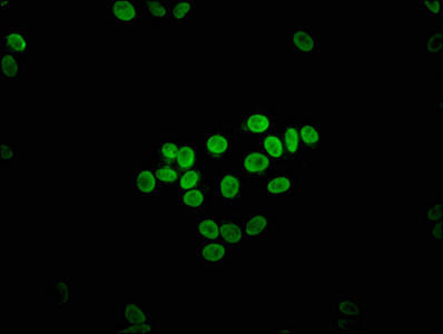 ETV2 Antibody (PACO62275)