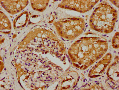 SBK2 Antibody (PACO62371)