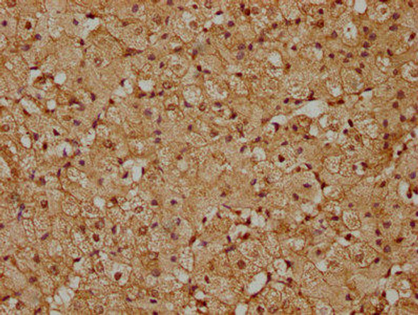 PIP4K2C Antibody (PACO62767)
