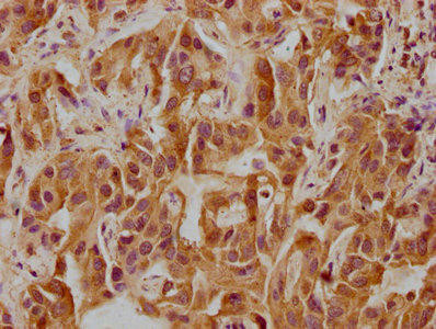 CELSR3 Antibody (PACO62783)