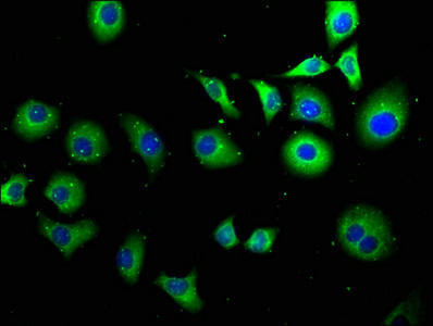 TPT1P8 Antibody (PACO62827)