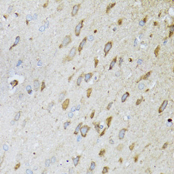 Anti-ND5 Antibody (CAB8135)