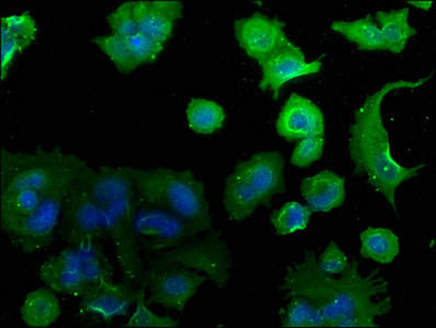 CAMK2N2 Antibody (PACO63631)