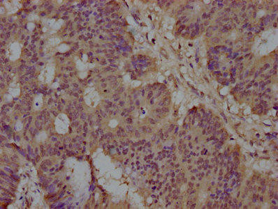 ST5 Antibody (PACO63711)