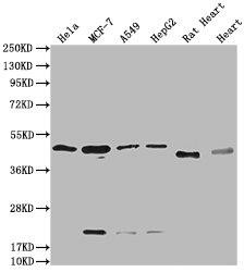 HTR3E Antibody (PACO64083)