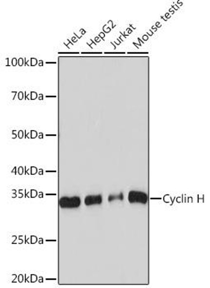 Anti-Cyclin H Antibody (CAB4076)