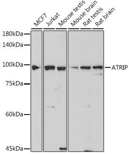 Anti-ATRIP Antibody (CAB19279)