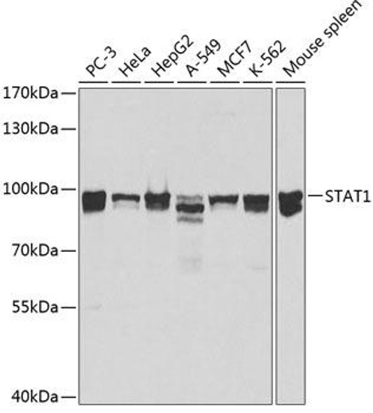 Anti-STAT1 Antibody (CAB0027)